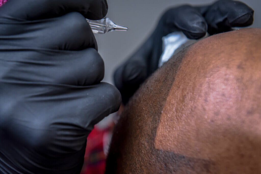 Scalp Micropigmentation In Dorset, Devon, Hampshire & Environs | SCALPPRO