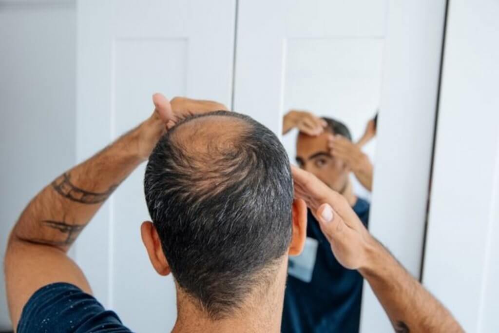 Scalp Micropigmentation In Dorset, Devon, Hampshire & Environs | SCALPPRO