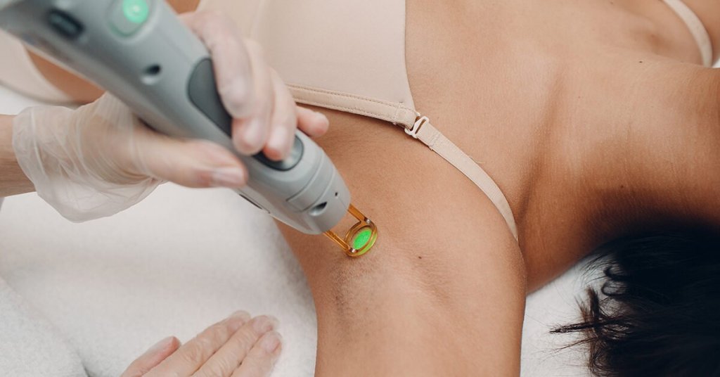 Laser Hair Removal Cause Cancer