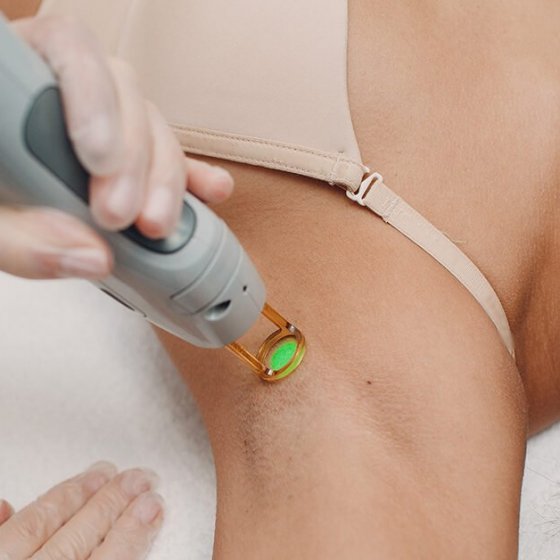 Laser Hair Removal Cause Cancer