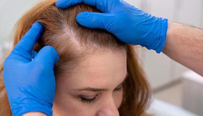 Female Hair Thinning Causes and Solutions